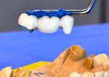 ZemFix Placement Instruments